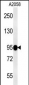 SEMA6A Antibody (N-term)