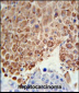 PHGDH Antibody (Center)