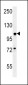 BUB1A Antibody (N-term)