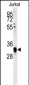 TFAP4 Antibody (C-term)