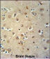 MEIS2 Antibody (Center D269)