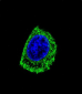 DDC Antibody (N-term)