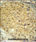 DDC Antibody (N-term)