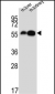 DDC Antibody (N-term)