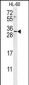 EMX2 Antibody (Center)