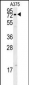 XRCC1 Antibody (Center)