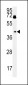 BDHA1 Antibody (Center)