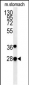 PREPL Antibody (C-term)