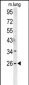 DNJC8 Antibody (C-term)