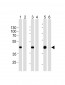 STEA2 Antibody (Center)