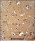 ZDHC2 Antibody  (N-term)