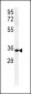 ZDHC2 Antibody  (N-term)