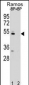 ZDHC2 Antibody  (N-term)