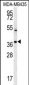 TNIP3 Antibody  (N-term)