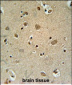 TRIM50 Antibody (C-term)