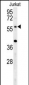 TRIM50 Antibody (C-term)