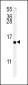 ADCYAP1 Antibody (C-term)