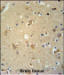 P2RX7 Antibody (C-term)