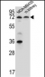 P2RX7 Antibody (C-term)