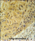 WNT5A Antibody (Center)