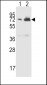 CFHR5 Antibody (Center)