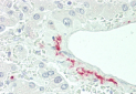 CFHR5 Antibody (Center)