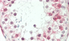 GP6 Antibody (C-term)