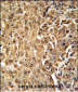 ZC3HAV1 Antibody (C-term)