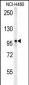 ZC3HAV1 Antibody (C-term)