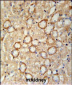 CRUM2 Antibody  (C-term)