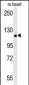 CRUM2 Antibody  (C-term)