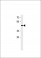 BHLH3 Antibody (N-term)