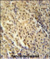 FOXC2 Antibody (Center S174)