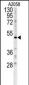 FOXC2 Antibody (Center S174)