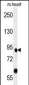 FOXP2 Antibody (C-term)