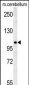 NDST2 Antibody (C-term)