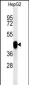 PON2 Antibody (Center)