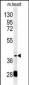 PON2 Antibody (Center)