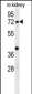 KLHL6 Antibody  (C-term)