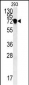 C4orf31 Antibody (N-term)