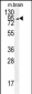 GIT1-S388 Antibody (Center)