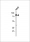 HCK Antibody (N-term)