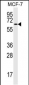 MAP2 Antibody (Ascites)