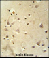 RSRC1 Antibody  (Center)