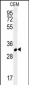 RSRC1 Antibody  (Center)