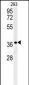 LGALS9B Antibody (Center)