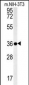 LGALS9B Antibody (Center)