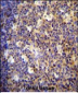 ALOX12B Antibody (C-term)