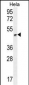 ANGPTL1 Antibody (N-term)