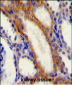 STIM1 Antibody (C-term)